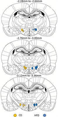 Increased Hypothalamic Projections to the Lateral Hypothalamus and Responses to Leptin in Rat Neonates From High Fat Fed Mothers